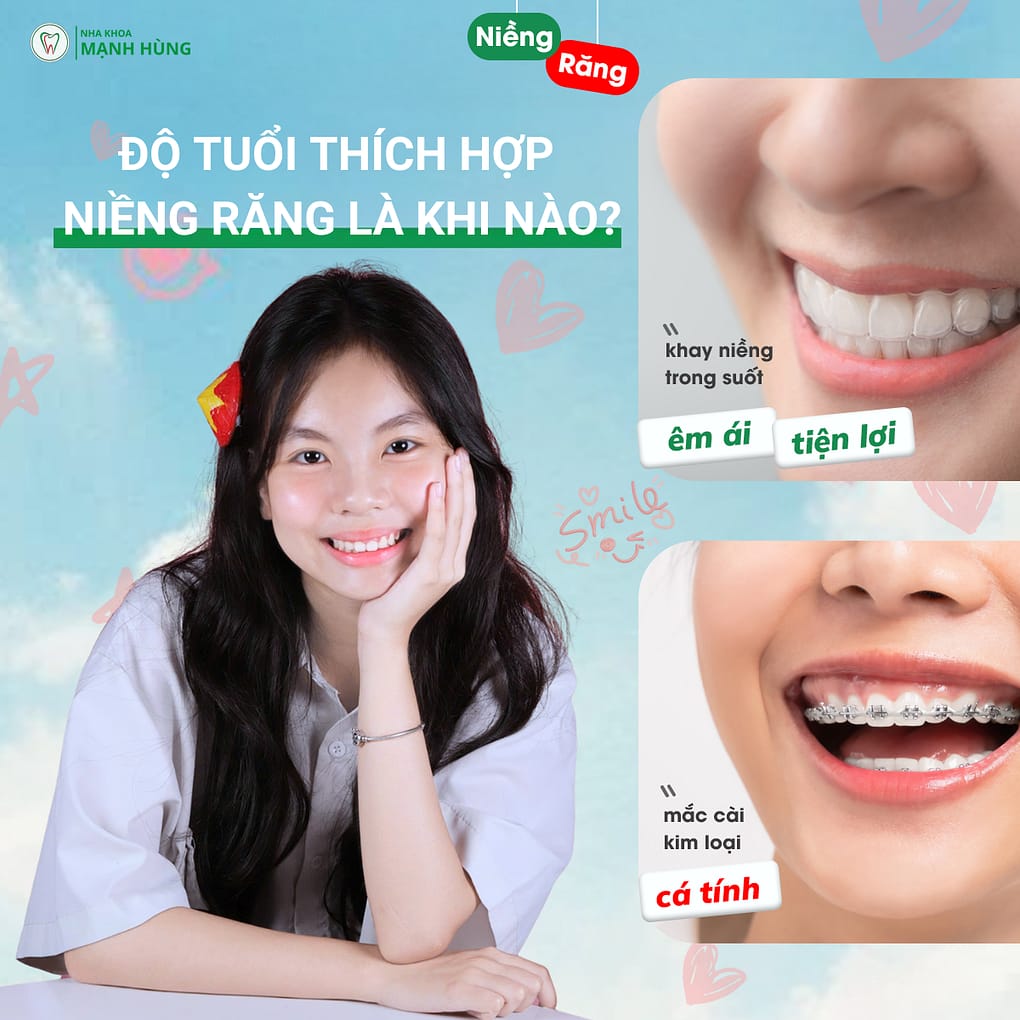 Độ tuổi thích hợp niềng răng là khi nào?