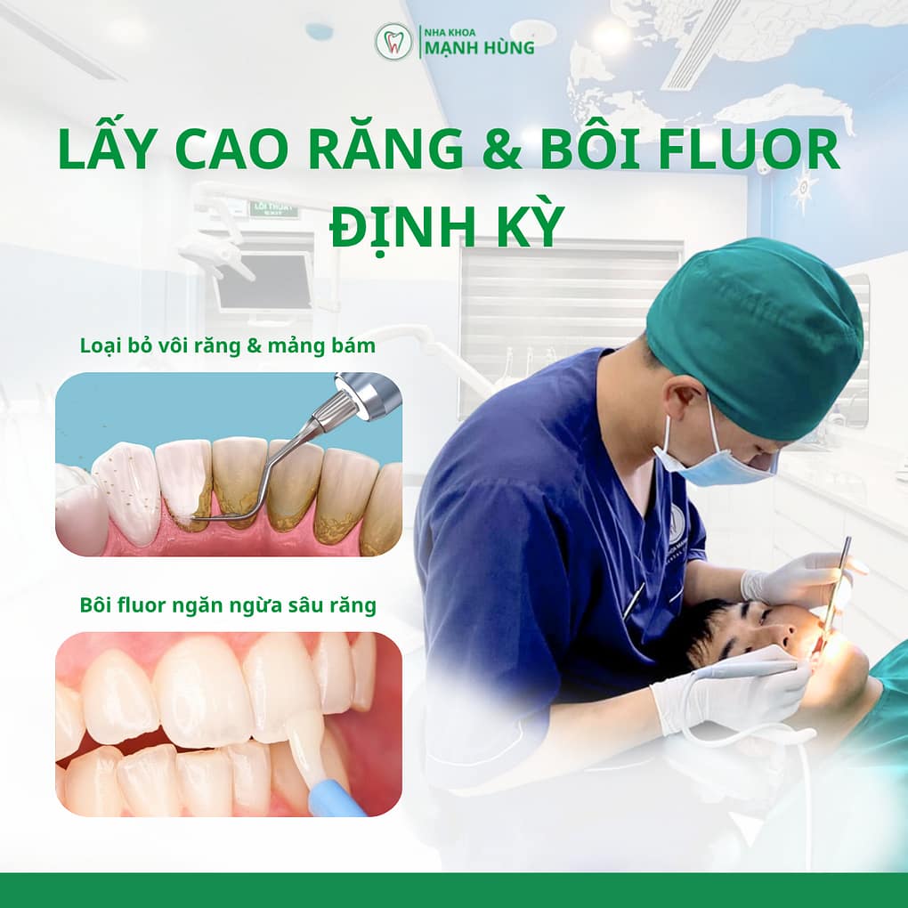 Lấy cao răng & bôi fluor định kỳ tại nha khoa Mạnh Hùng