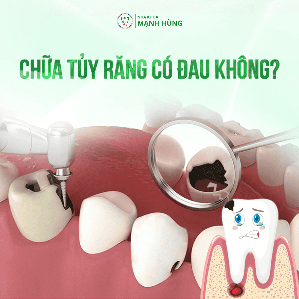 Chữa tủy răng có đau không tại nha khoa Mạnh Hùng