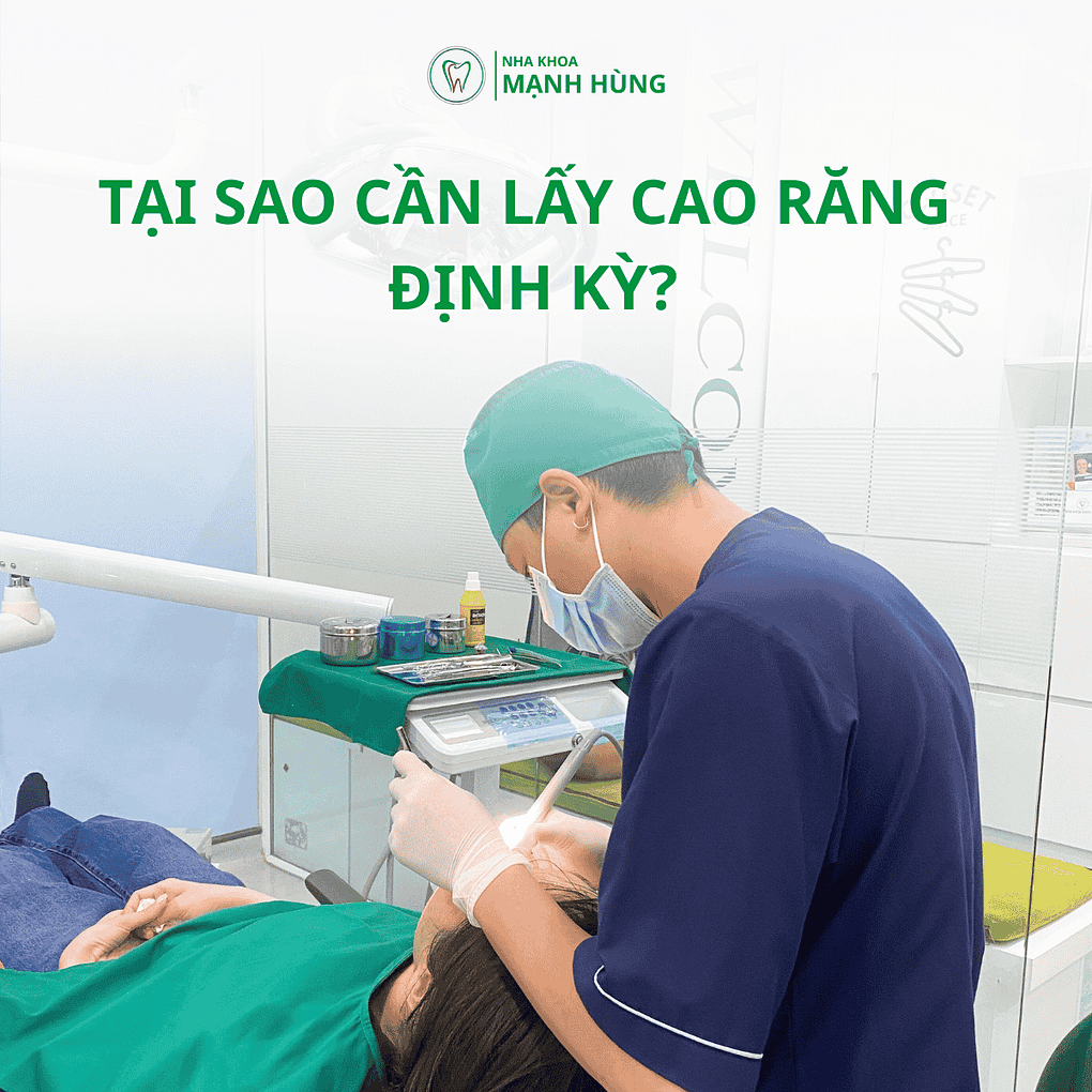 Cao răng là gì và tại sao cần loại bỏ định kỳ?