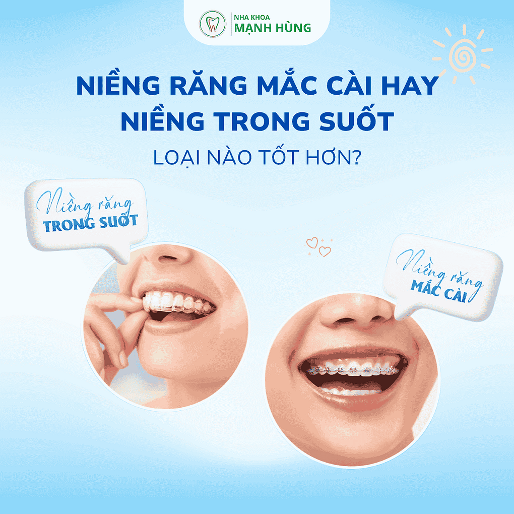 Niềng răng mắc cài hay niềng trong suốt: Loại nào tốt hơn?