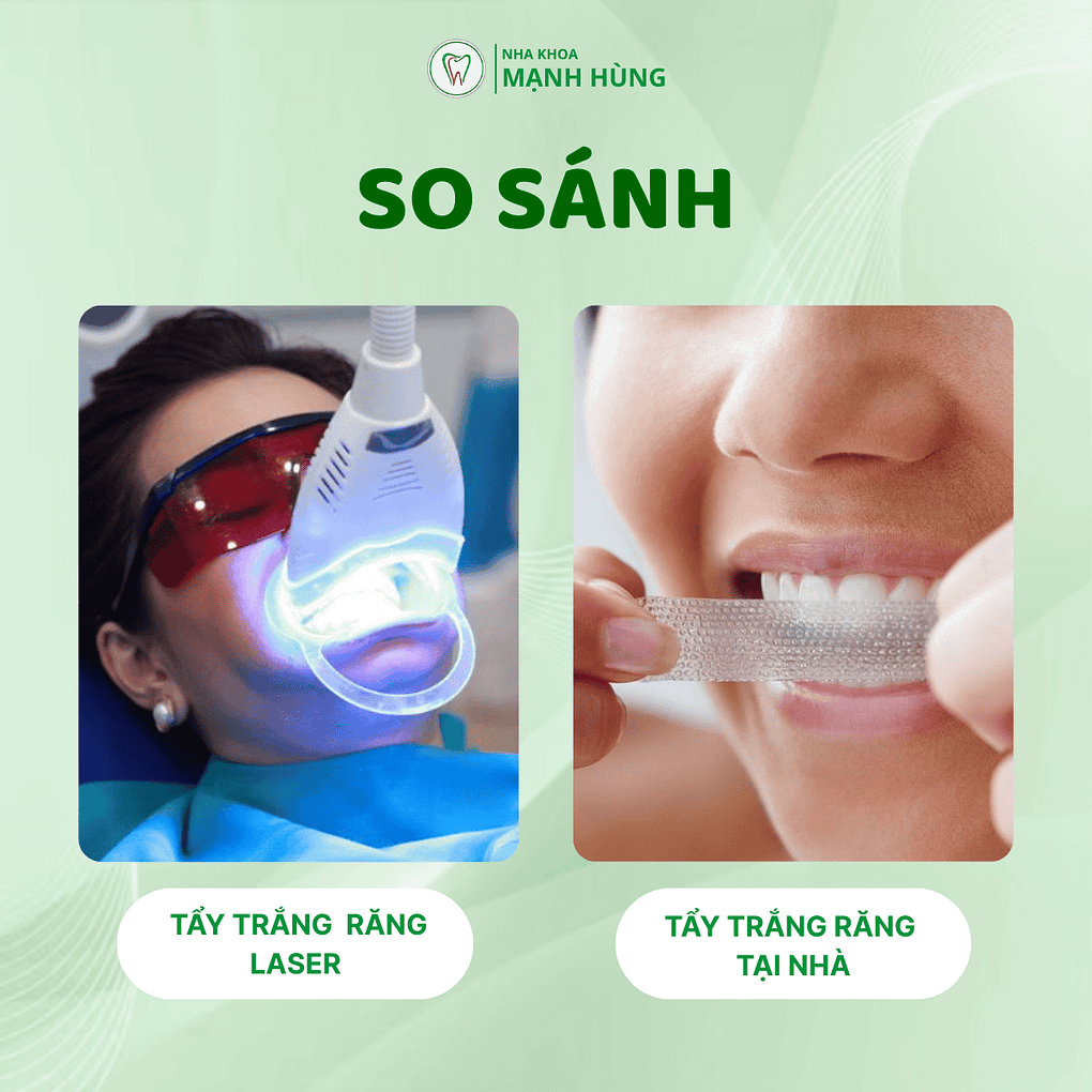 so sánh tẩy trắng răng laser với tẩy trắng răng tại nhà