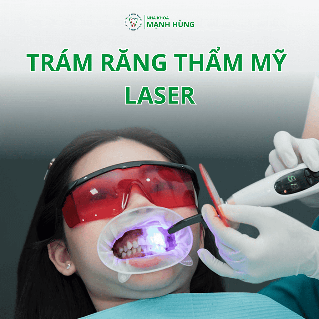 Trám răng thẩm mỹ laser tại Nha khoa Mạnh Hùng