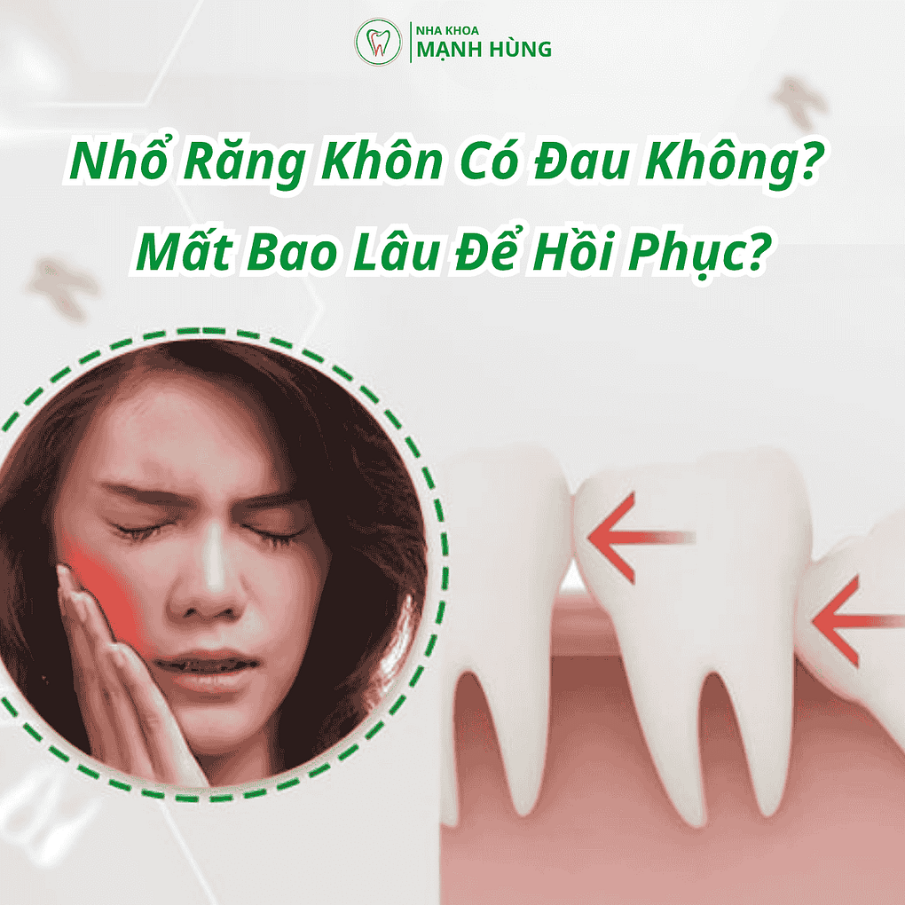 Nhổ Răng Khôn Có Đau Không? Mất Bao Lâu Để Hồi Phục?