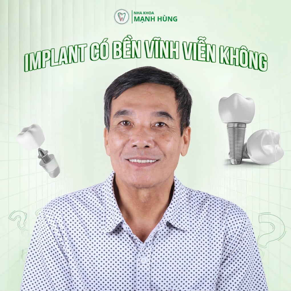 Trồng răng implant có bền vĩnh viễn không