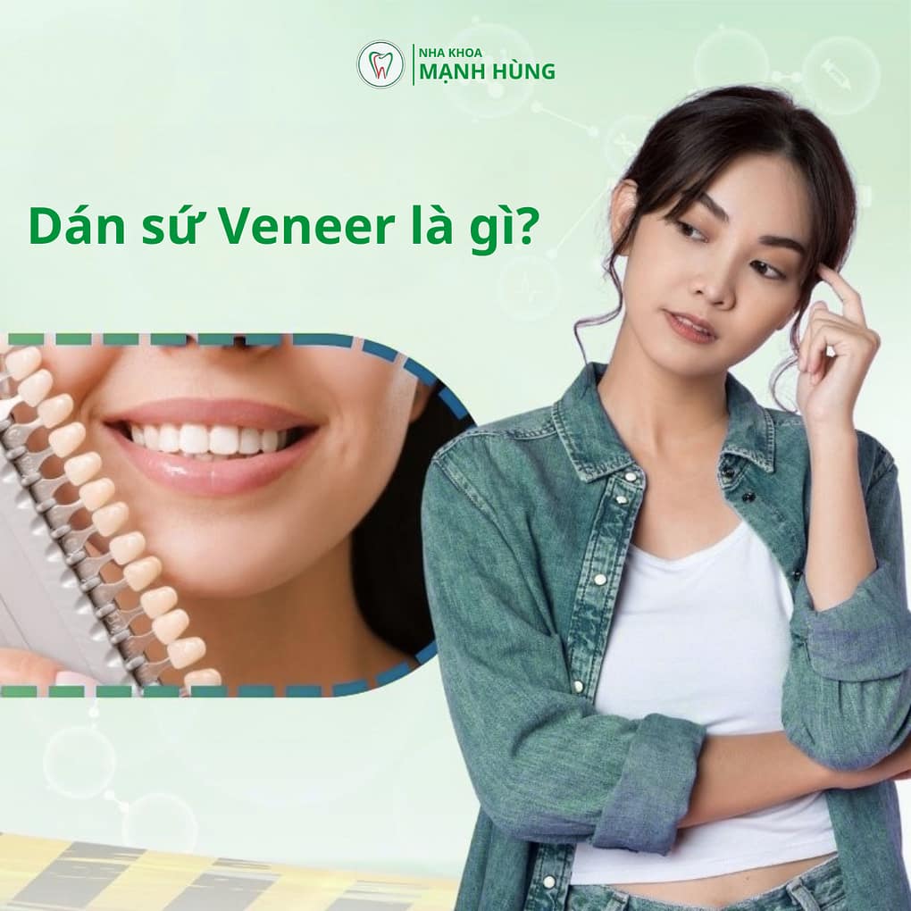 Dán sứ veneer tại Nha khoa Mạnh Hùng