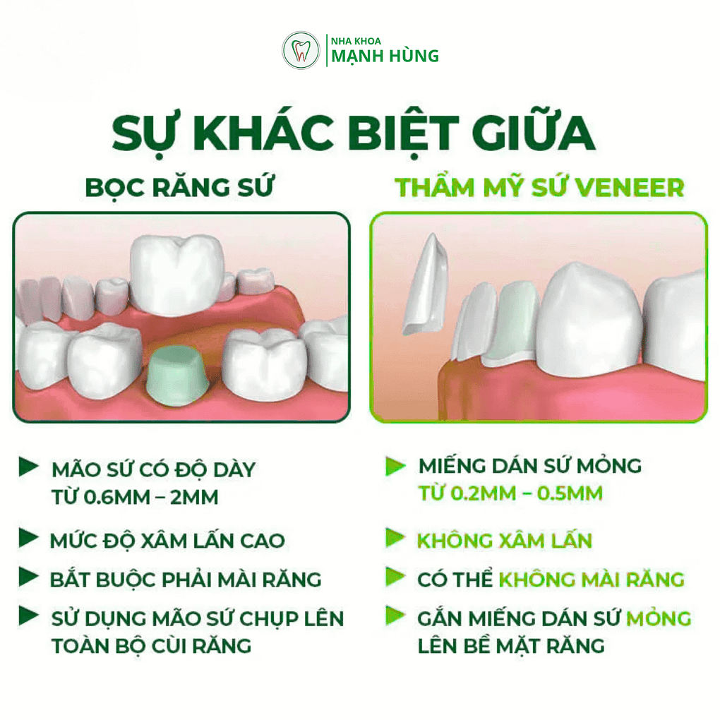 Khác biệt giữa răng sứ và veneer: Bạn nên chọn gì? tại nha khoa Mạnh Hùng