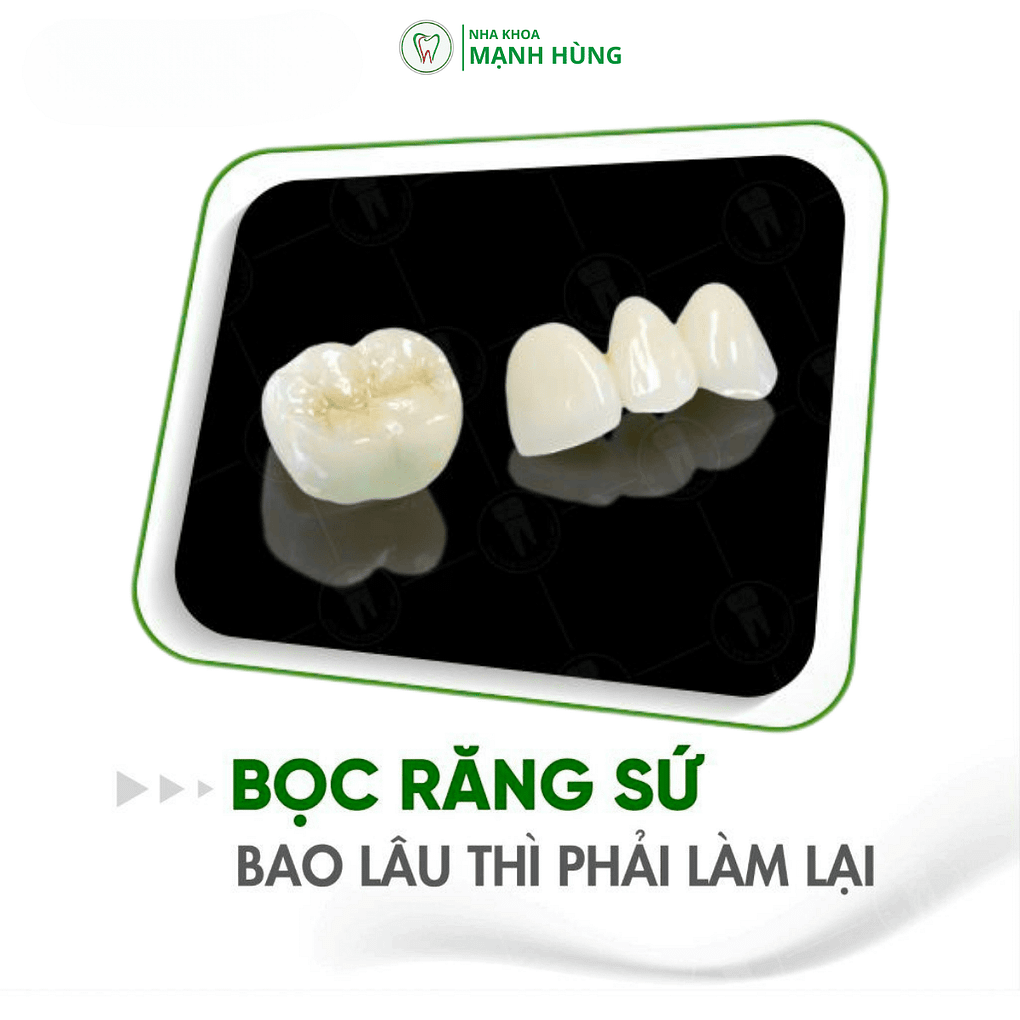 Bọc răng sứ bao lâu phải làm lại tại nha khoa Mạnh Hùng