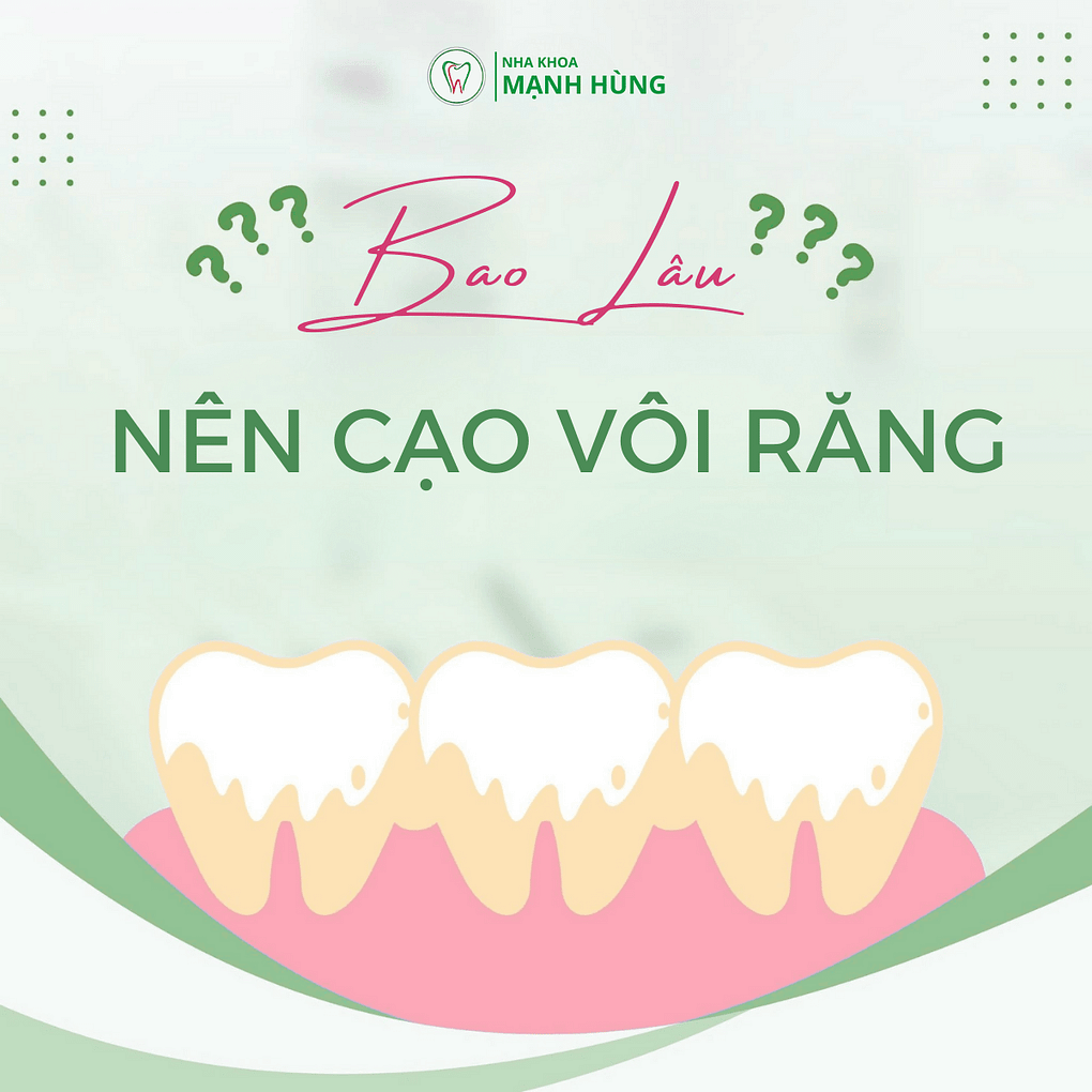 Bao lâu cạo vôi răng một lần thì tốt nhất?