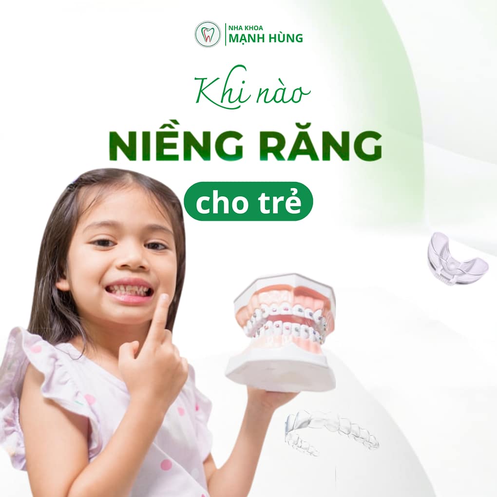 khi nào trẻ cần niềng răng