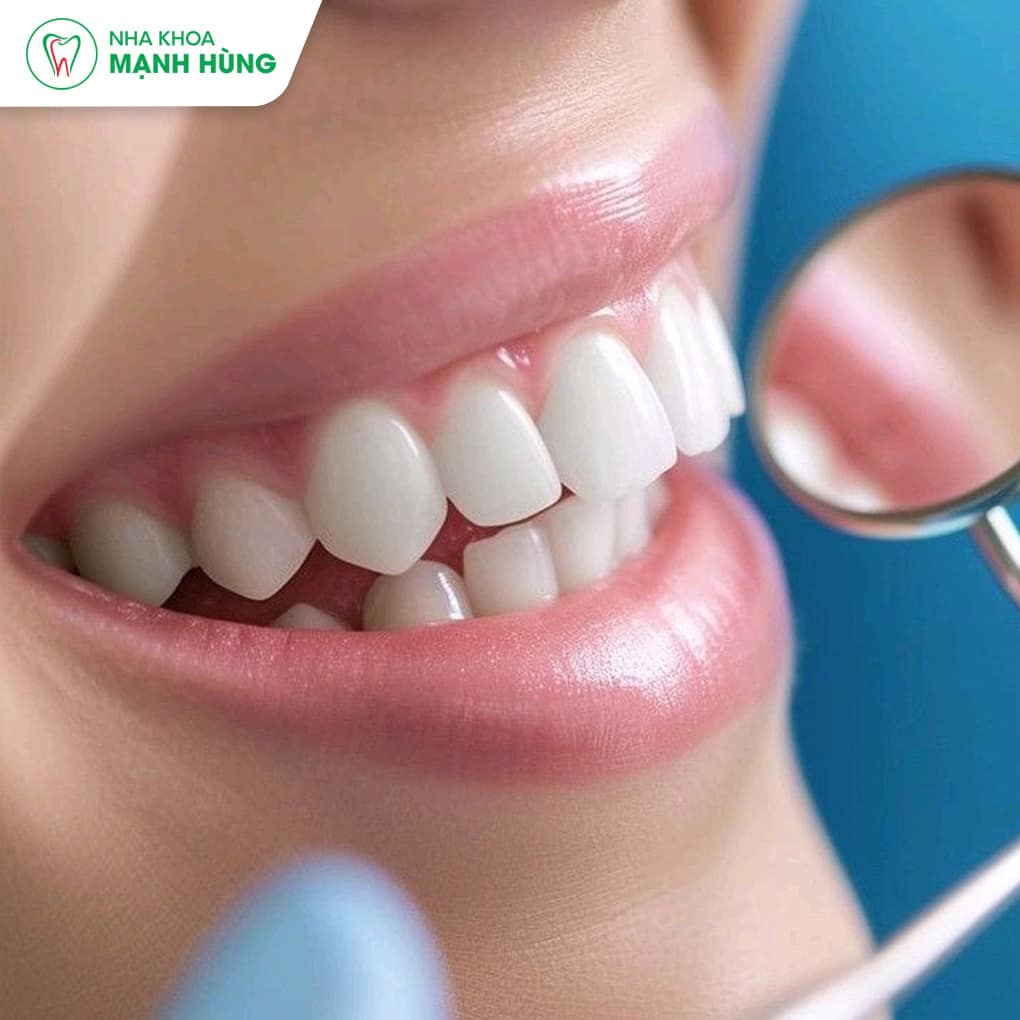 răng sứ hải phòng