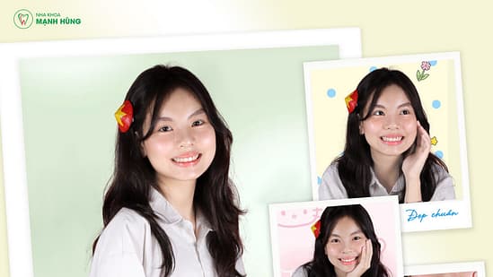 Khách hàng niềng răng tại Nha khoa Mạnh Hùng