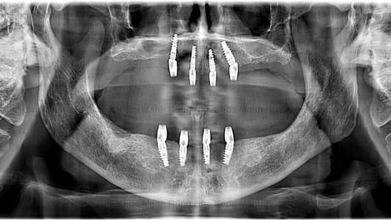 Lập kế hoạch điều trị cá nhân hóa