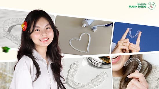 Giai đoạn dậy thì (12 – 16 tuổi): Thời điểm vàng để niềng răng