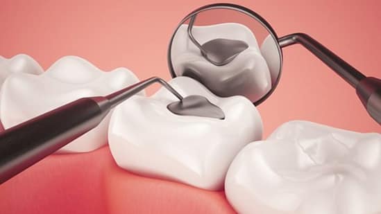 Mô phỏng quá trình hàn răng