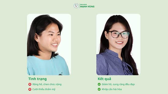 Khách hàng chỉnh nha tại Nha Khoa Mạnh Hùng