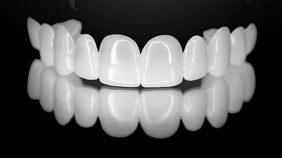 Ưu điểm nổi bật của răng sứ thẩm mỹ