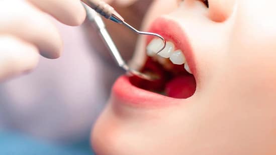 Dịch vụ nha khoa tổng quát tại Nha khoa Mạnh Hùng