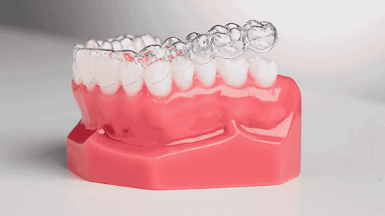 niềng răng khay trong suốt tại nha khoa Mạnh Hùng