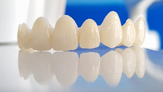 răng sứ thẩm mỹ