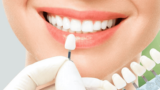 Bọc răng sứ bao lâu phải làm lại tại nha khoa Mạnh Hùng