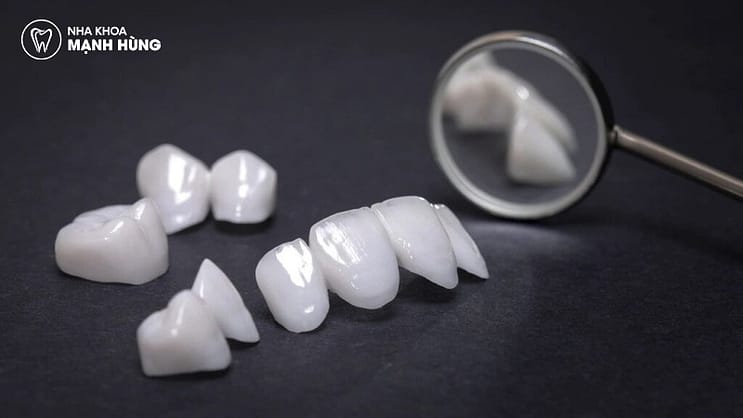 Răng toàn sứ có cấu trúc nguyên khối từ sứ, đảm bảo độ trong và tự nhiên.