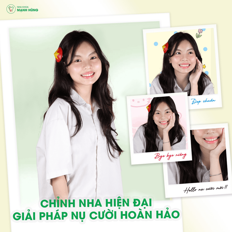 Chỉnh nha hiện đại – Giải pháp nụ cười hoàn hảo tại Nha khoa Mạnh Hùng